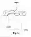 Fig. 40 - Methods of designing and manufacturing customized dental prosthesis for periodontal or osseointegration and related systems