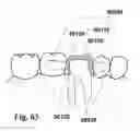 Fig. 42 - Methods of designing and manufacturing customized dental prosthesis for periodontal or osseointegration and related systems