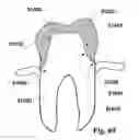 Fig. 48 - Methods of designing and manufacturing customized dental prosthesis for periodontal or osseointegration and related systems