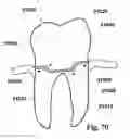 Fig. 49 - Methods of designing and manufacturing customized dental prosthesis for periodontal or osseointegration and related systems