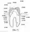 Fig. 50 - Methods of designing and manufacturing customized dental prosthesis for periodontal or osseointegration and related systems
