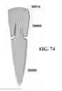 Fig. 53 - Methods of designing and manufacturing customized dental prosthesis for periodontal or osseointegration and related systems