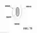 Fig. 54 - Methods of designing and manufacturing customized dental prosthesis for periodontal or osseointegration and related systems