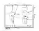 Fig. 60 - Methods of designing and manufacturing customized dental prosthesis for periodontal or osseointegration and related systems