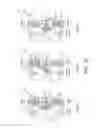 Fig. 09 - Nozzle for oral irrigator device including a dynamic nozzle actuator with responsive materials