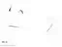 Fig. 07 - STRUCTURALLY ENHANCED TISSUE GRAFT