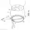 Fig. 12 - Roll-down vascular graft device