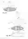 Fig. 05 - Prosthetic iris preparation method
