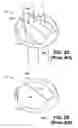 Fig. 03 - Trileaflet mechanical prosthetic heart valve