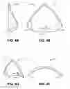 Fig. 06 - Trileaflet mechanical prosthetic heart valve