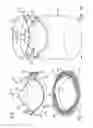 Fig. 02 - Heart valve with integrated stent and sewing ring