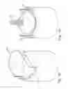 Fig. 04 - Heart valve with integrated stent and sewing ring