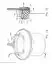 Fig. 07 - Heart valve with integrated stent and sewing ring