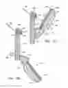 Fig. 13 - Heart valve with integrated stent and sewing ring