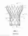 Fig. 02 - Subannular sealing for paravalvular leak protection