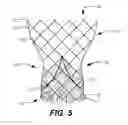 Fig. 08 - Subannular sealing for paravalvular leak protection