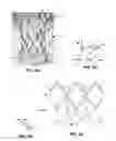 Fig. 09 - Subannular sealing for paravalvular leak protection
