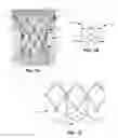 Fig. 10 - Subannular sealing for paravalvular leak protection