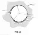 Fig. 16 - Subannular sealing for paravalvular leak protection