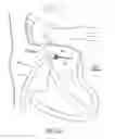 Fig. 12 - Methods for delivery of heart valve devices using intravascular ultrasound imaging