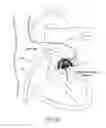 Fig. 16 - Methods for delivery of heart valve devices using intravascular ultrasound imaging