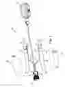 Fig. 02 - Penile prosthetic with an insertion sleeve attachable to an inflatable bladder