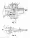 Fig. 09 - Pump for an implantable penile prosthetic, the pump having a spherical part positioned within a flow path of the pump