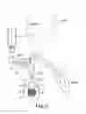 Fig. 10 - Pump for an implantable penile prosthetic, the pump having a spherical part positioned within a flow path of the pump
