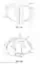 Fig. 04 - Tibial prosthesis for tibia with varus resection