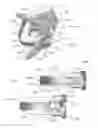 Fig. 02 - Expandable intervertebral implant