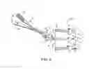 Fig. 06 - METHODS AND APPARATUS FOR INTERVERTEBRAL DISC PROSTHESIS INSERTION