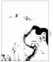 Fig. 02 - Treatment systems processes and devices addressing cerebral vasospasm/vasoconstriction