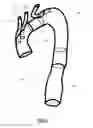 Fig. 02 - MODULAR SYSTEM WITH AT LEAST ONE BRANCH GRAFT