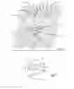 Fig. 03 - Helical stent having improved flexibility and expandability