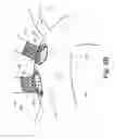 Fig. 05 - Stroke prevention devices, systems, and methods