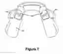 Fig. 06 - Cuspid and first bi-cuspid bite retainer for sleep apnea