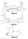 Fig. 07 - Cuspid and first bi-cuspid bite retainer for sleep apnea