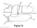 Fig. 09 - Cuspid and first bi-cuspid bite retainer for sleep apnea