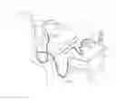 Fig. 01 - Saliva management system with continuous flow through oral device