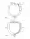 Fig. 05 - Saliva management system with continuous flow through oral device