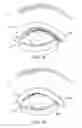 Fig. 12 - Combination treatment systems