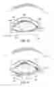 Fig. 13 - Combination treatment systems