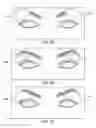 Fig. 16 - Combination treatment systems