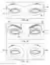 Fig. 17 - Combination treatment systems