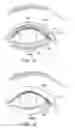 Fig. 21 - Combination treatment systems