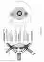 Fig. 06 - Sonic and ultrasonic contact lens apparatus