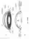 Fig. 19 - Sonic and ultrasonic contact lens apparatus