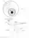 Fig. 03 - Method and apparatus for reducing intraocular pressure