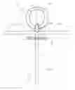 Fig. 08 - Method and apparatus for reducing intraocular pressure