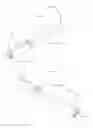 Fig. 15 - Method and apparatus for reducing intraocular pressure